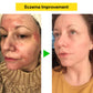 East Asia Eczema & Psoriasis Natural Herbal Cream