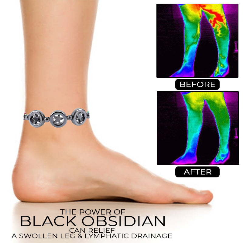 Anti Swelling Obsidian Therapy Anklet VerseVida